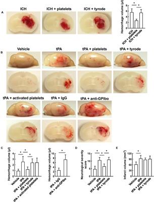 Transfusion of Resting Platelets Reduces Brain Hemorrhage After Intracerebral Hemorrhage and tPA-Induced Hemorrhage After Cerebral Ischemia